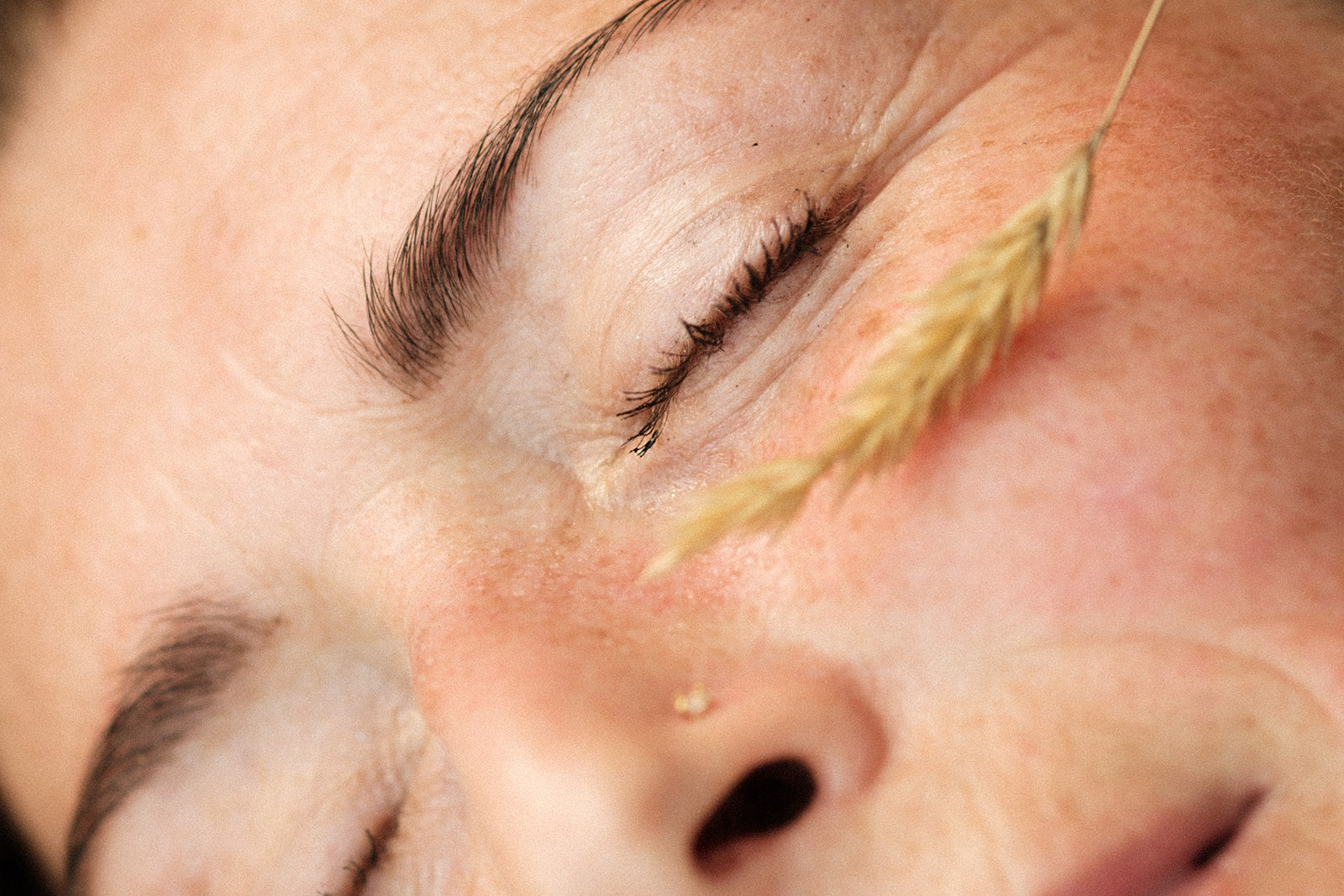 Who Says You Have Sensitive Skin?